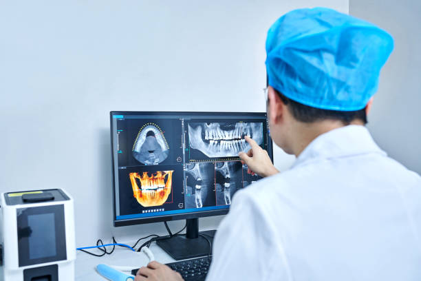Best Knocked-Out Tooth (Avulsed Tooth) Treatment in Colton, CA